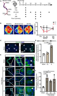 Transient ischemic stroke triggers sustained damage of the choroid plexus blood-CSF barrier